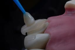 a close-up of a toothbrush — Photo Ozkan Guner / Unsplash